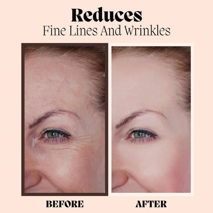 Hyaluronic Acid Serum